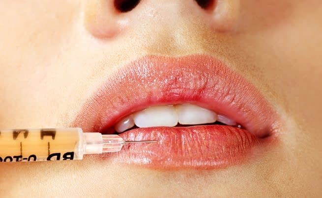 Botox / fillers